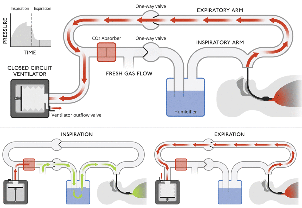 Closed circuit ventilators: This diagram is more like a modern medical ventilator. A CO2 filter recycles air to reduce waste. An outflow valve controlled by the ventilator releases pressure that builds up as more and more fresh air is added to the closed system.